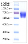 Active Recombinant Human PD-1/PDCD1/CD279 Protein (RP00072)
