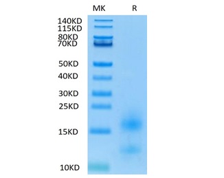 Biotinyalted Recombinant Human TNFRSF17/BCMA/CD269 Protein (RP02284)