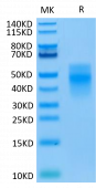 Recombinant Human TREM-1/CD354 Protein (RP02088)