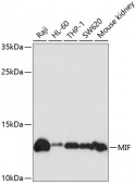 [One Step] MIF antibody Kit (RK05730)