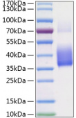 Active Recombinant Human CSF-1/M-CSF Protein (RP01221)