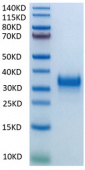 Recombinant Human Fc-gamma RIIb/CD32b Protein (RP02012)