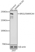 [KO Validated] BRG1/SMARCA4 Rabbit pAb (A2117)