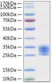 Recombinant Mouse IL-6 Protein (RP01321)