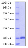 Recombinant Human IL-18 Protein (RP00006)
