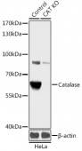 [KO Validated] Catalase Rabbit pAb (A18018)