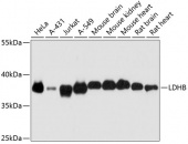 [One Step] LDHB antibody Kit (RK05731)
