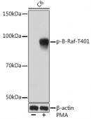 Phospho-B-Raf-T401 Rabbit mAb (AP1041)