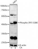 Phospho-IRF3-S386 Antibody kit (RK05793)