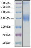 Recombinant Human VEGFR-2/KDR/CD309 Protein (RP00084)