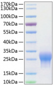 Recombinant Human ALK-1/ACVRL1 Protein (RP00978)
