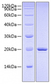 Recombinant Mouse Sonic hedgehog protein/SHH Protein (RP00632)