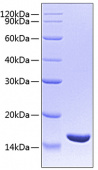 Recombinant Human TNF-beta/LT-alpha Protein (RP00506)