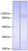 Recombinant Mouse IL-23R Protein (RP00689)