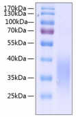 Active Recombinant Human c-Kit ligand/SCF/KITLG Protein (RP00124)