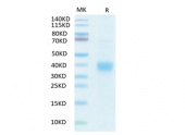 Recombinant Human KP43/CD94 Protein (RP02317)