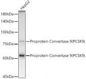 [KD Validated] Proprotein Convertase 9(PCSK9) Rabbit mAb (A11532)