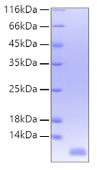 Recombinant Human IL-8/GCP-1/NAP-1 Protein (RP00052)