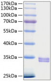 Recombinant Human TNFRSF1A/TNF-R1/CD120a Protein (RP01130)