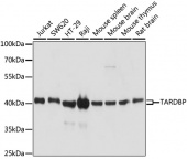 [One Step]TARDBP Antibody Kit (RK05713)