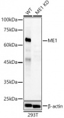 [KD Validated] ME1 Rabbit pAb (A23068)