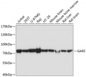 [One Step] GARS antibody Kit (RK05739)