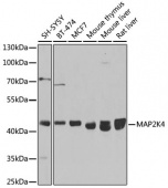 [KO Validated] MAP2K4 Rabbit pAb (A14781)