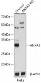 [KO Validated] ANXA3 Rabbit pAb (A19862)