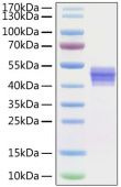 Recombinant Human IL-12B Protein (RP01288)
