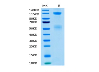 Recombinant Human IGF1R/CD221 Protein (RP02385)