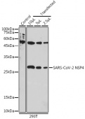 SARS-CoV-2 NSP4 Rabbit pAb (A20281)