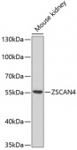 ZSCAN4C Rabbit pAb (A10205)