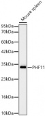 [KD Validated] PHF11 Rabbit mAb (A23994)