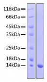 Recombinant Human Beta-NGF Protein (RP00428)
