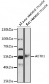 ABTB1 Rabbit pAb (A18499)