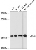 [One Step] UBE2I antibody Kit (RK05734)