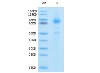 Recombinant Human IL-13RA2/CD213a2 Protein (RP02420)