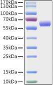Recombinant Mouse LAG-3/CD223 Protein (RP01327)
