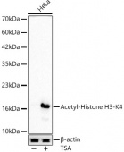 Acetyl-Histone H3-K4 Rabbit mAb (A24341)