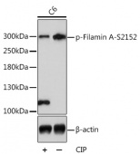 Phospho-FLNA-S2152 Antibody kit (RK05766)