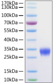 Рекомбинантный белок Fc-gamma RIIb/CD32b человека (Recombinant Human Fc-gamma RIIb/CD32b Protein)
