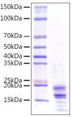 Recombinant Human IL-17A/CTLA-8 Protein (RP01510)