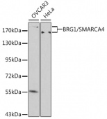 [KO Validated] BRG1/SMARCA4 Rabbit pAb (A0887)