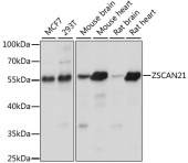 ZSCAN21 Rabbit pAb (A15330)