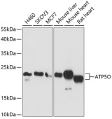 [One Step] ATP5O antibody Kit (RK05733)