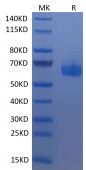 Recombinant Human TNFRSF14/HVEM/CD270 Protein (RP02379)