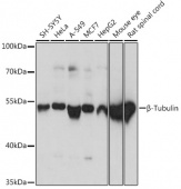β-Tubulin Rabbit pAb (AC015)