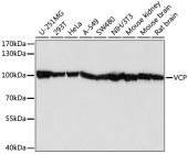 [One Step]VCP Antibody Kit (RK05721)
