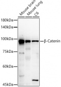β-Catenin Rabbit pAb (A11512)