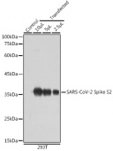SARS-CoV-2 Spike S2 Rabbit pAb (A20284)